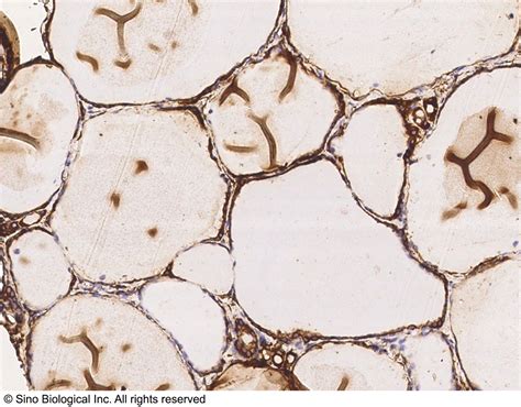 Thyroid Peroxidasetpo Antibodies Anti Thyroid Peroxidasetpo Sino