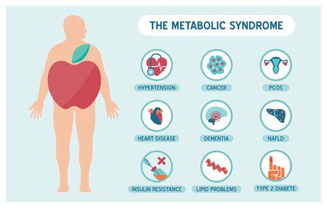 Metabolic Syndrome: The Connection between Obesity, Diabetes...