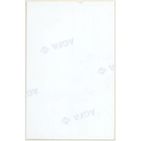 Natural Brunette Female On Meadow Boobs Flash Vintage Photo Germany S