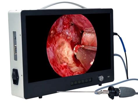 Portable Full Hd Endoscope Camera For Ent Urology Laparoscopy