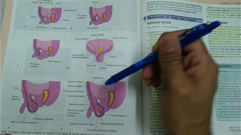 Descent Of Testis Anatomy Youtube