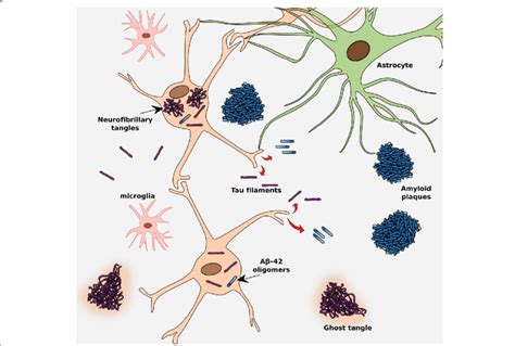 Tau Pathology In Relation To Other Pathological Features In Alzheimer S