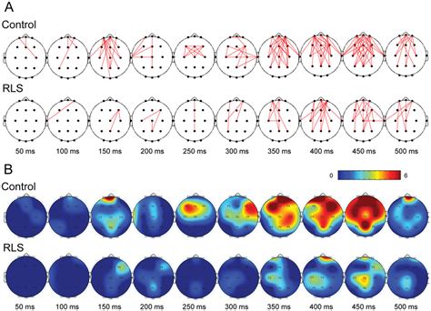 Spatiotemporal Pattern Of Gamma Band Phase Synchronization Gbps A