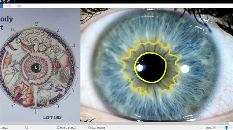 Iridology Lesson Iris Reading Youtube