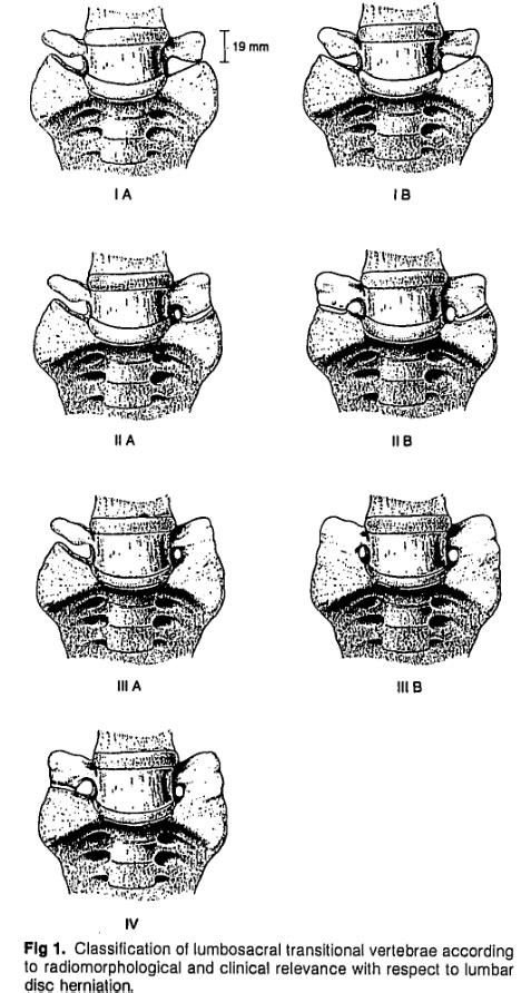 Castellvi Classification Ars Neurochirurgica
