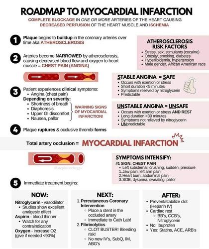 ROADMAP TO MYOCARDIAL INFARCTION Flashcards Quizlet