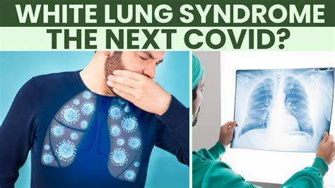 What Is White Lung Syndrome Here Is What You Need To Know The Health Site Youtube