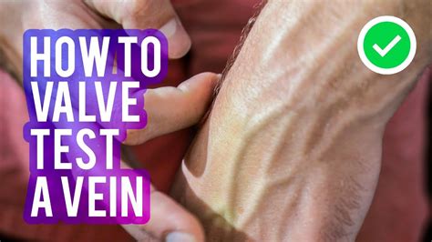 How To Valve Test A Vein When Starting An IV Or Drawing Blood