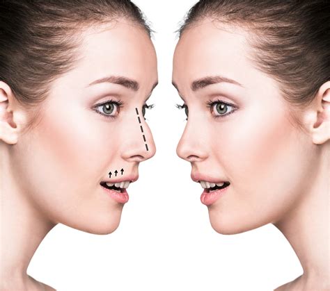 The Most Popular Plastic Surgery Procedures For Women