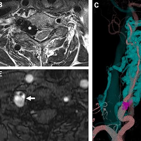 Magnetic Resonance Imaging And Computed Tomography Angiography A Download Scientific Diagram