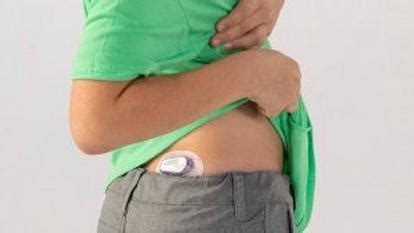 Dexcom G6 CGM – Glucose Monitoring System | Dexcom