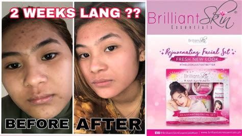 2 Weeks Of Using Brilliant Skin Rejuvenating Set Honest Review Youtube