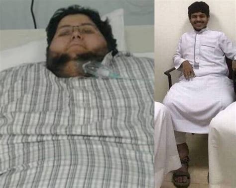 Worlds Heaviest Man Unrecognisable As He Loses 542kg After Offer From