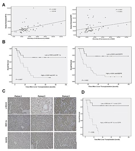 Combined γ H2ax Hif 1α And Egfr Has Better Prognostic Value For Hcc