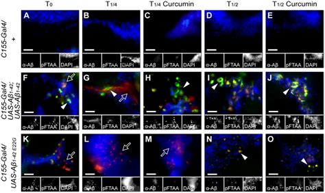 Curcumin Affects The Brain Amyloid Deposition Histology Patterns As A