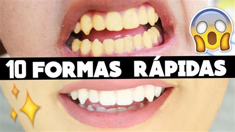 Formas De Clarear Os Dentes Em Casa R Pido F Cil E Barato Youtube