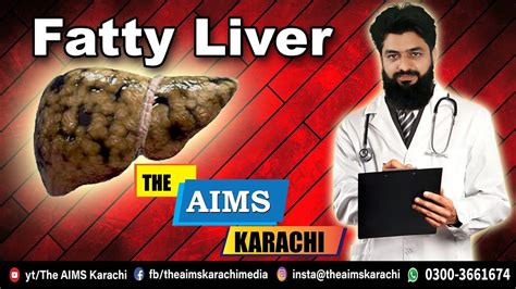 Fatty Liver Disease By Dr Nasir Javed Jigar Pr Charbi Fatty