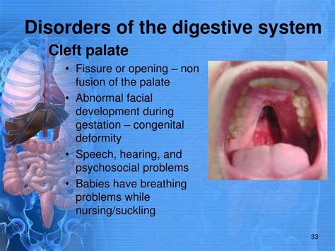 Ppt Digestive System Powerpoint Presentation Free Download Id 1607177