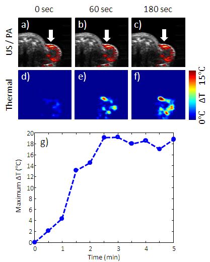 Combined Ultrasound And Photoacoustic Images And Photoacoustic Based