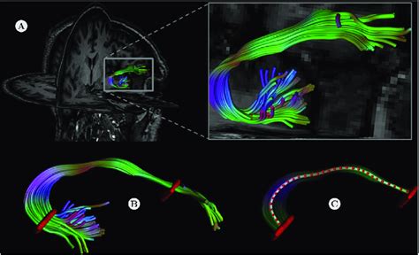 An Example Of Along Tract Analysis A The Uncinate Fasciculus Is First