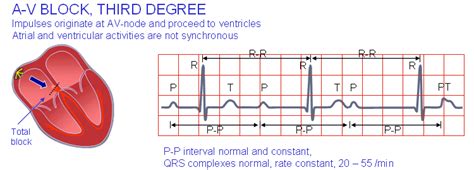 19 The Basis Of Ecg Diagnosis