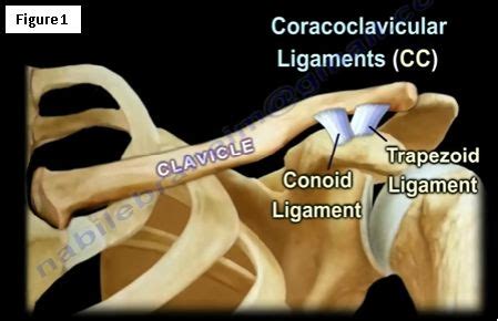 clavicle fractures huffpost contributor