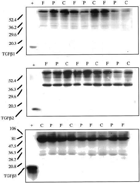 Western Blot Analysis For TGF 1 2 And 3 In Human Third