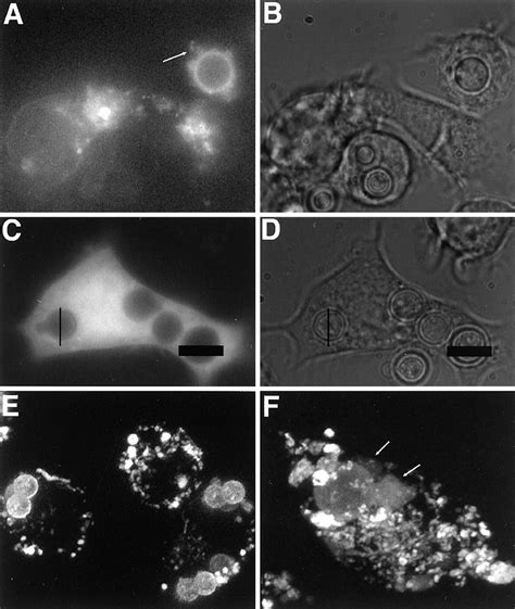 Cryptococcus Neoformans Culture