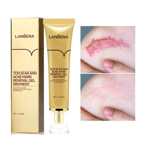 LANBENA Crema para eliminar cicatrices y acné Gel reparador de la piel