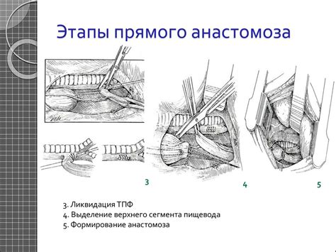 Атрезия пищевода - презентация онлайн