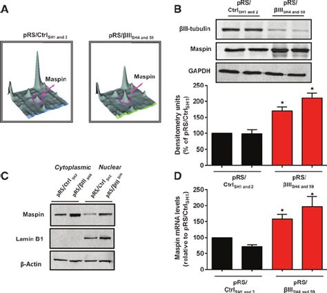 Suppression Of B Iii Tubulin Increases The Expression Of Maspin In