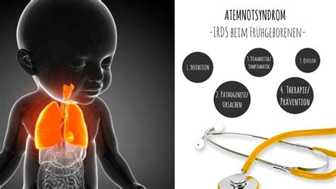 Atemnotsyndrom Bei Einem Fr Hchen By Vivian Siewert