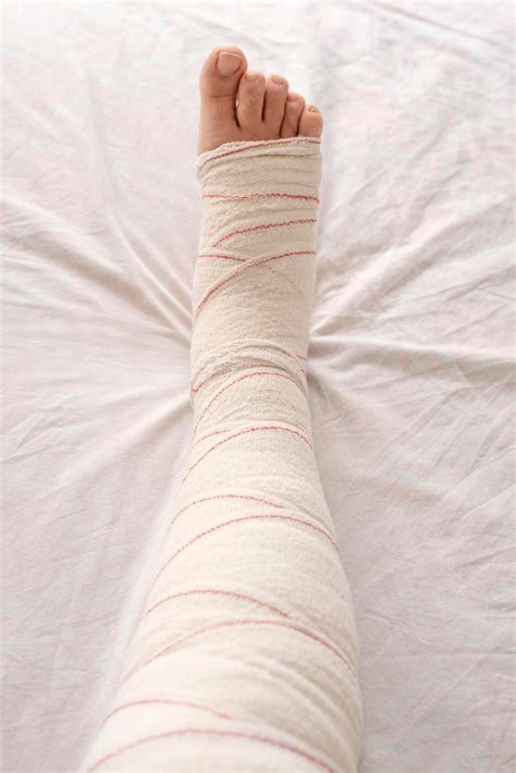 Premium Photo Leg In Bandage