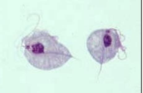Trichomonas Diagram | Quizlet