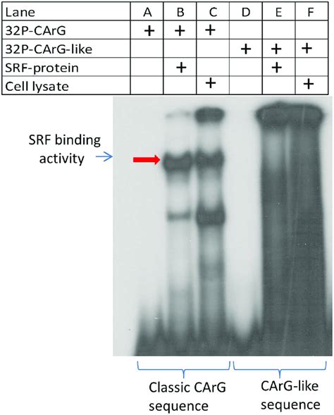 Electrophoretic Mobility Shift Assay Emsa Confirms That Srf Protein