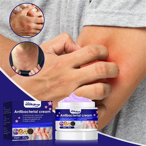 Anti Itch Creamplant Extract Ointment Cream Quickly Resolve Itchy Extra Strength Anti Itch