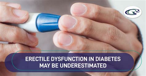 Erectile Dysfunction In Diabetes May Be Underestimated Urology Hospital