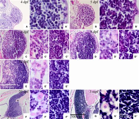 Thymus Histology