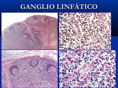 Histología De Tejido Linfoide Ppt