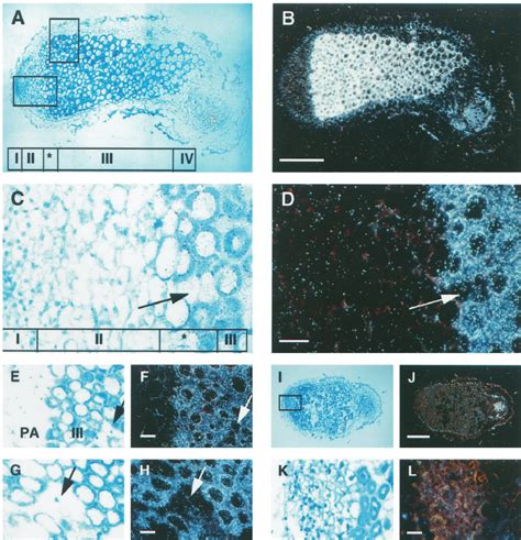 Localization Of Nadh Gogat Mrna In Alfalfa Root Nodules By In Situ