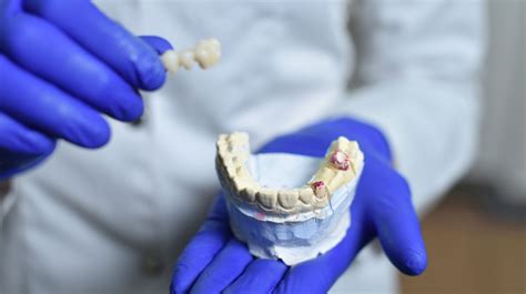 Le déchaussement des dents causes et traitements