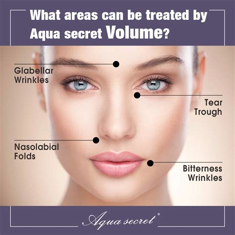 Aqua Secret Hyaluronic Acid Dermal Filler With Lidocaine China Dermal