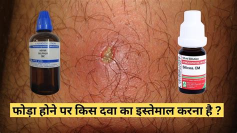 फोड़ा बालतोड़ Boil Homeopathic Medicine For Boils Youtube