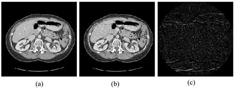 Applied Sciences Free Full Text Sparse View Computed Tomography Reconstruction Based On A