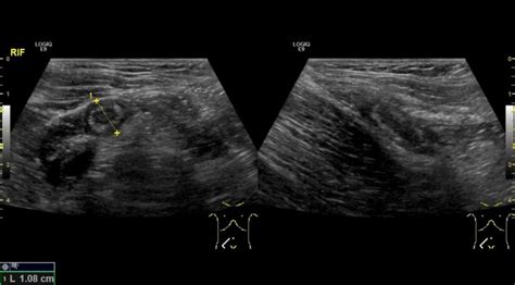 Basics techniques needed to evaluate the Appendix! – Integrated ...