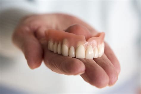 Denture Stomatitis Online Dentist