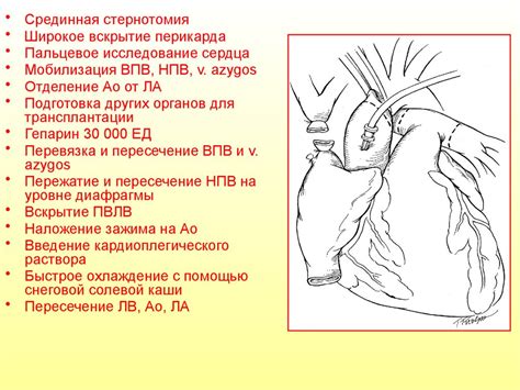 Пересадка сердца - презентация онлайн
