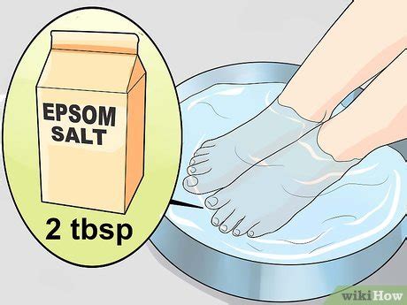 Ways To Heal An Ingrown Toenail Wikihow