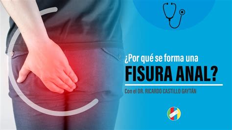 Por Qu Se Forma Una Fisura Anal Youtube