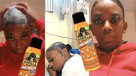 Gorilla Glue Girl Tessica Brown Is Getting 3 Day Surgical Procedure To Get Gorilla Glue Out Her